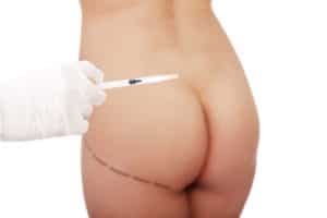 Brazilian Butt Lift Beverly Hills  Los Angeles Surgeons - Procedure,  Advantages