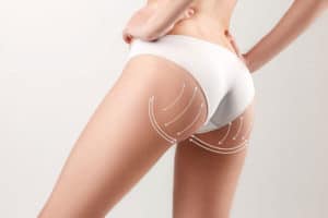 Brazilian Butt Lift Beverly Hills  Los Angeles Surgeons - Procedure,  Advantages