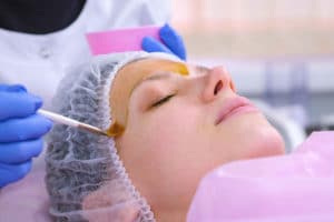 chemical peel