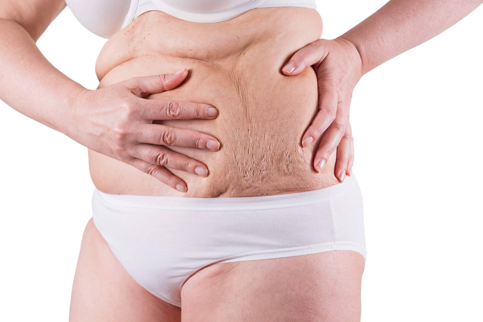 Tummy Tuck Surgery: How it Can Help You?