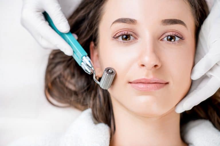 microneedling