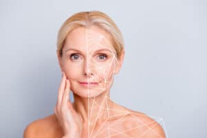 Beverly Hills Skin Tightening